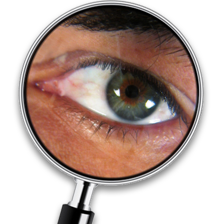 Online-Schädlings-Bekämpfung – Kammerjäger für Stuttgart – AML Schädlingsbekämpfung